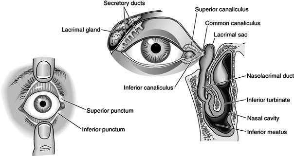 Figure 1-24