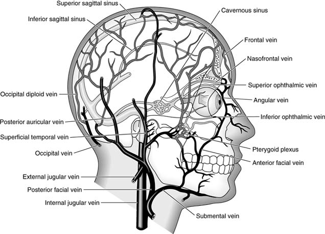 Figure 1-6