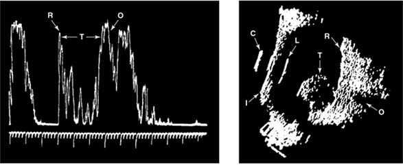 Figure 2-33