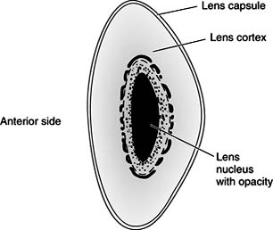 Figure 8-5