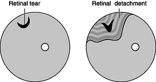 Figure 9-12