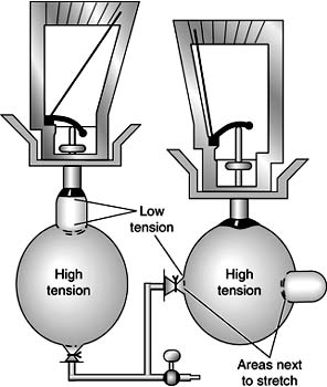 Figure 11-2