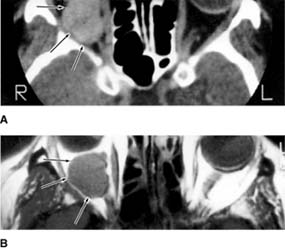 Figure 13-7