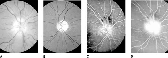 Figure 14-13