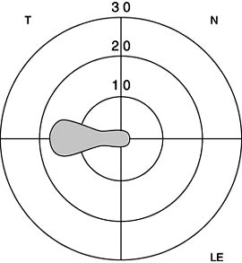 Figure 14-20