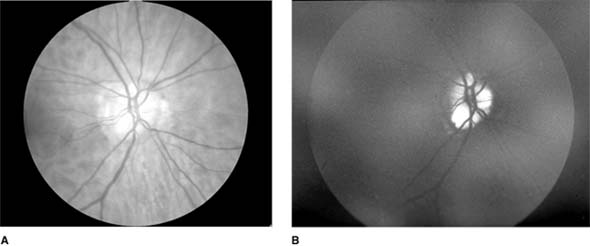 Figure 14-25