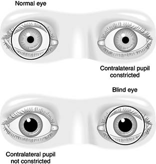 Figure 14-33