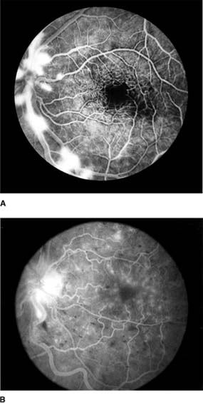 Figure 15-12