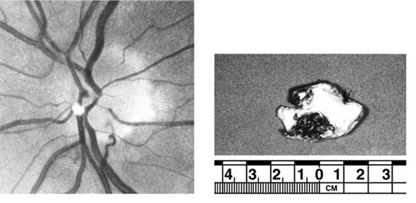 Figure 15-6