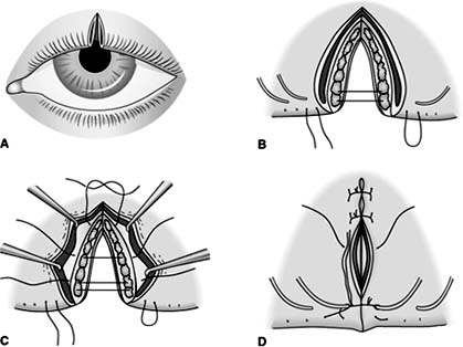 Figure 19-1